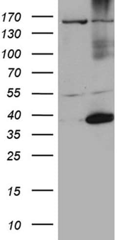 HSF2BP Monoclonal Antibody (OTI2A1), TrueMAB , OriGene:Antibodies:Primary