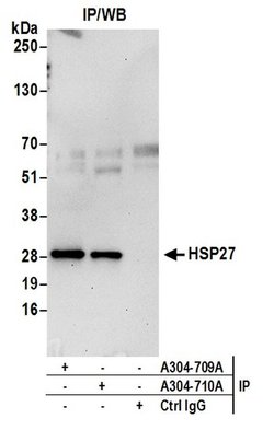 HSP27 Rabbit anti-Human, Polyclonal, Bethyl Laboratories 100 μL; Unconjugated:Antibodies,
