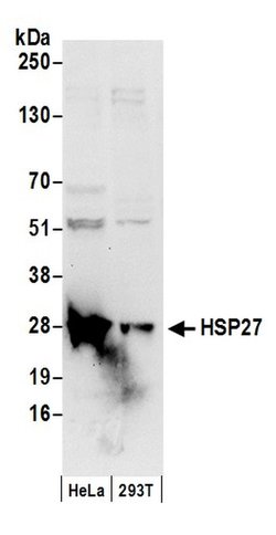 HSP27 Rabbit anti-Human, Polyclonal, Bethyl Laboratories 100 μL; Unconjugated:Antibodies,