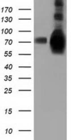 HSPA6 Mouse anti-Human, Clone: OTI1H3, lyophilized, TrueMAB 100 &mu;g;