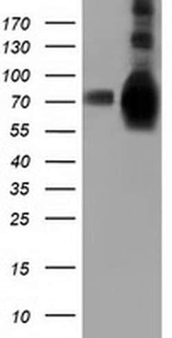 HSPA6 Monoclonal Antibody (OTI1H3), TrueMAB , OriGene:Antibodies:Primary