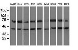 HSPA6 Mouse anti-Human, Clone: OTI1H3, lyophilized, TrueMAB 100 &mu;g;