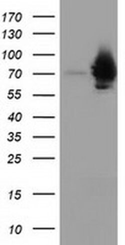 HSPA6 Monoclonal Antibody (OTI2C2), TrueMAB , OriGene 100 &mu;L; Unconjugated:Antibodies,