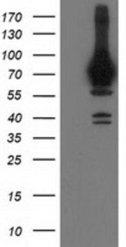 HSPA6 Mouse anti-Human, Clone: OTI1D12, lyophilized, TrueMAB 100 &mu;g;
