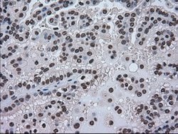 HSPA9 Mouse anti-Canine, Human, Rat, Clone: OTI9F8, lyophilized, TrueMAB