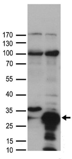 HSPB1 Rabbit anti-Human, Mouse, Polyclonal, liquid, OriGene 100 &mu;L;
