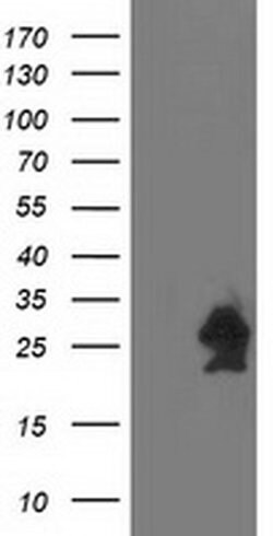 HSPB7 Mouse anti-Human, Clone: OTI1D11, liquid, TrueMAB 100 &mu;L; Unconjugated:Antibodies,