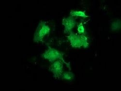 HSPB8 Mouse anti-Human, Rat, Clone: OTI1E3, lyophilized, TrueMAB 100 &mu;g;