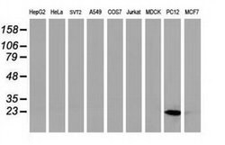 HSPB8 Monoclonal Antibody (OTI1E3), TrueMAB , OriGene 100 &mu;L; Unconjugated:Antibodies,