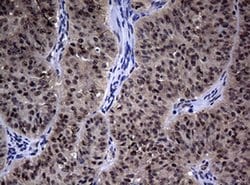 Hsp60 (HSPD1) Monoclonal Antibody (OTI1B3), TrueMAB , OriGene:Antibodies:Primary