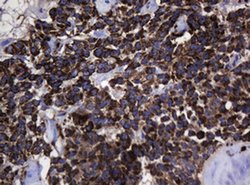 Hsp60 (HSPD1) Monoclonal Antibody (OTI3A2), TrueMAB , OriGene 100 &mu;L;