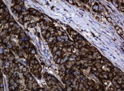 Hsp60 (HSPD1) Monoclonal Antibody (OTI3A2), TrueMAB , OriGene 100 &mu;L;