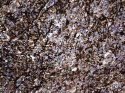 Hsp60 (HSPD1) Monoclonal Antibody (OTI3G1), TrueMAB , OriGene 100 &mu;L;