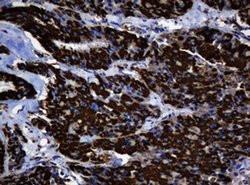 Hsp60 (HSPD1) Monoclonal Antibody (OTI3G1), TrueMAB , OriGene 100 &mu;L;