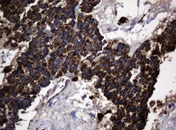 Hsp60 (HSPD1) Monoclonal Antibody (OTI3G1), TrueMAB , OriGene 100 &mu;L;