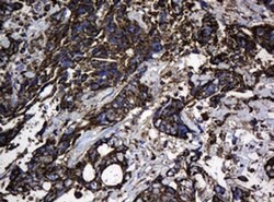 Hsp60 (HSPD1) Monoclonal Antibody (OTI3G1), TrueMAB , OriGene 100 &mu;L;