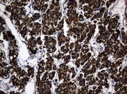 Hsp60 (HSPD1) Monoclonal Antibody (OTI3G1), TrueMAB , OriGene 100 &mu;L;