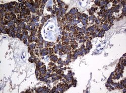 Hsp60 (HSPD1) Monoclonal Antibody (OTI6F7), TrueMAB , OriGene 100 &mu;L;