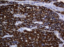 Hsp60 (HSPD1) Monoclonal Antibody (OTI6F7), TrueMAB , OriGene 100 &mu;L;
