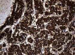 Hsp60 (HSPD1) Monoclonal Antibody (OTI6F7), TrueMAB , OriGene 100 &mu;L;