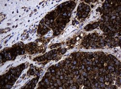 Hsp60 (HSPD1) Monoclonal Antibody (OTI6F11), TrueMAB , OriGene:Antibodies:Primary