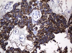 Hsp60 (HSPD1) Monoclonal Antibody (OTI6F11), TrueMAB , OriGene 100 &mu;L;