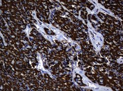 Hsp60 (HSPD1) Monoclonal Antibody (OTI6F11), TrueMAB , OriGene 100 &mu;L;