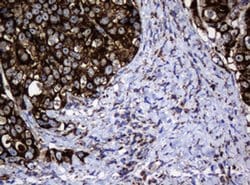 Hsp60 (HSPD1) Monoclonal Antibody (OTI6F11), TrueMAB , OriGene 100 &mu;L;