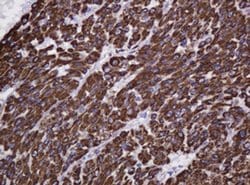 Hsp60 (HSPD1) Monoclonal Antibody (OTI3G10), TrueMAB , OriGene 100 &mu;L;