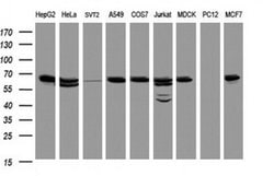 Hsp60 (HSPD1) Monoclonal Antibody (OTI3A2), TrueMAB , OriGene 100 &mu;L;
