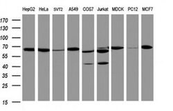 Hsp60 (HSPD1) Monoclonal Antibody (OTI3G1), TrueMAB , OriGene 100 &mu;L;