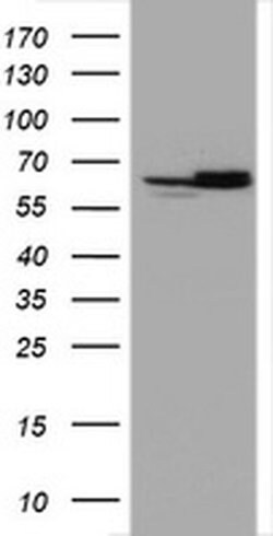 Hsp60 (HSPD1) Monoclonal Antibody (OTI6F11), TrueMAB , OriGene:Antibodies:Primary