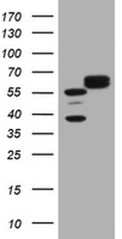 Hsp60 (HSPD1) Monoclonal Antibody (OTI3G10), TrueMAB , OriGene 100 &mu;L;