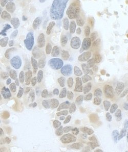 HURP/DLG7 Rabbit anti-Human, Polyclonal, Bethyl Laboratories 100 &mu;L;
