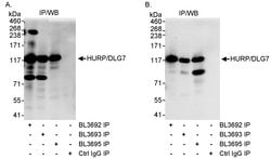 HURP/DLG7 Rabbit anti-Human, Polyclonal, Bethyl Laboratories 100 &mu;l;