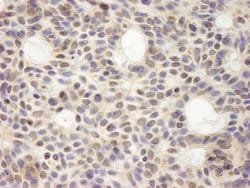 HURP/DLG7 Polyclonal Antibody, Bethyl Laboratories 10 &mu;L | Buy Online | Bethyl Laboratories, Inc | Fisher Scientific