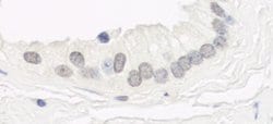 Haspin Rabbit anti-Human, Polyclonal, Bethyl Laboratories 100 &mu;L; Unconjugated:Antibodies,