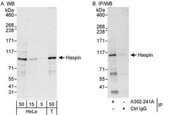 Haspin Rabbit anti-Human, Polyclonal, Bethyl Laboratories 100 &mu;L; Unconjugated:Antibodies,