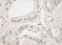 Haspin Polyclonal Antibody, Bethyl Laboratories:Antibodies:Primary Antibodies
