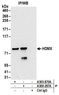 HdmX/MDM4 Goat anti-Human, Polyclonal, Bethyl Laboratories 100 &mu;L; Unconjugated:Antibodies,