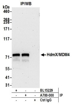 HdmX/MDM4 Recombinant Rabbit Monoclonal Antibody (BL-3-2F2), Bethyl Laboratories:Antibodies:Primary