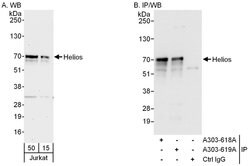 Helios Rabbit anti-Human, Polyclonal, Bethyl Laboratories 100 &mu;L; Unconjugated:Antibodies,