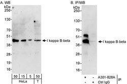 I kappa B-beta Rabbit anti-Human, Polyclonal, Bethyl Laboratories 100 &mu;L;