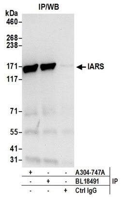 IARS Rabbit anti-Human, Polyclonal, Bethyl Laboratories 100 &mu;L; Unconjugated:Antibodies,