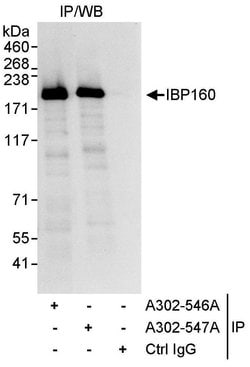 IBP160 Rabbit anti-Human, Polyclonal, Bethyl Laboratories 10 &mu;L; Unconjugated:Antibodies,
