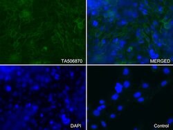 ICAM1 Monoclonal Antibody (OTI2H4), TrueMAB , OriGene 30 &mu;L; Unconjugated:Antibodies,