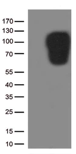 ICAM1 Monoclonal Antibody (OTI2H4), TrueMAB , OriGene 30 &mu;L; Unconjugated:Antibodies,