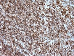 ICAM3 Mouse anti-Human, Clone: OTI1C2, lyophilized, TrueMAB 100 &mu;g;