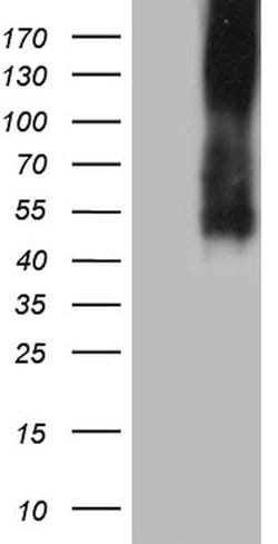 ICOSLG Mouse anti-Human, Clone: UMAB254, lyophilized, UltraMAB 100 &mu;g;