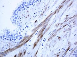 ICT1 Mouse anti-Human, Clone: OTI2F9, lyophilized, TrueMAB 100 &mu;g; Unconjugated:Antibodies,